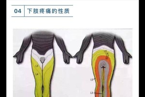 乒乓球拉球肌肉酸痛解决方法（如何缓解乒乓球拉球后的肌肉酸痛）